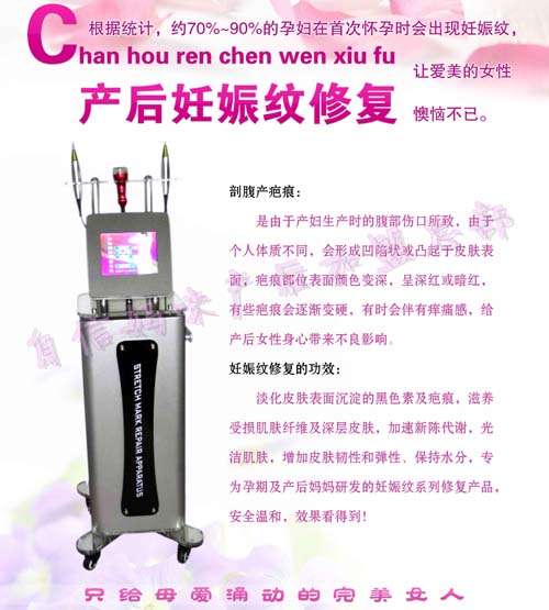 自信妈咪产后妊娠纹修复