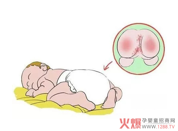 秋冬红屁股.jpg