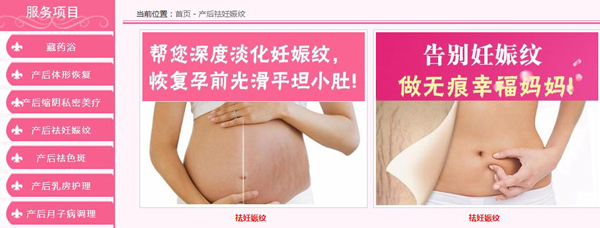 同汇妈妈产后祛妊娠纹.jpg