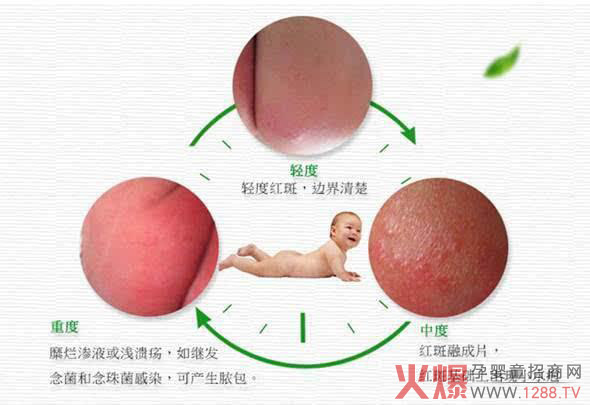 红屁股.jpg