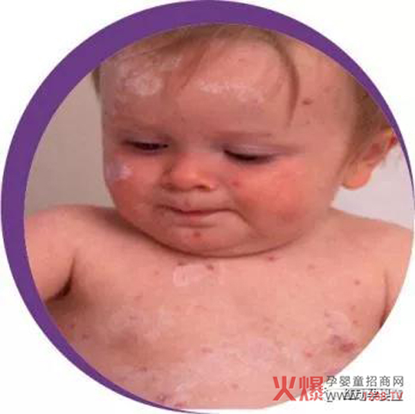如何让孩子有自己的抵抗力2.jpg