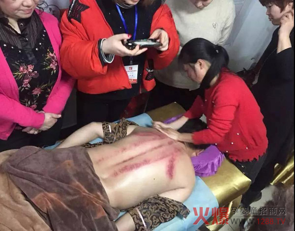 药王府中医灸疗师培训会5.jpg