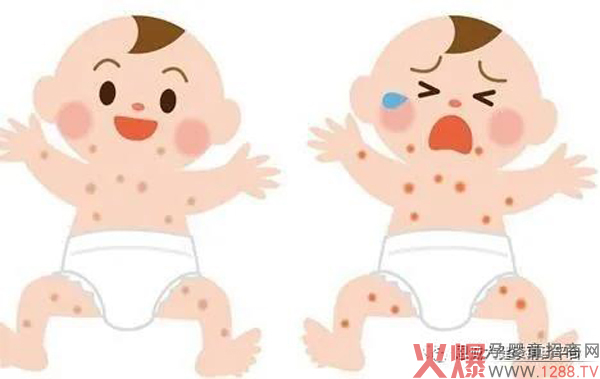 “宝童健”蚊虫叮咬止痒膏2.jpg
