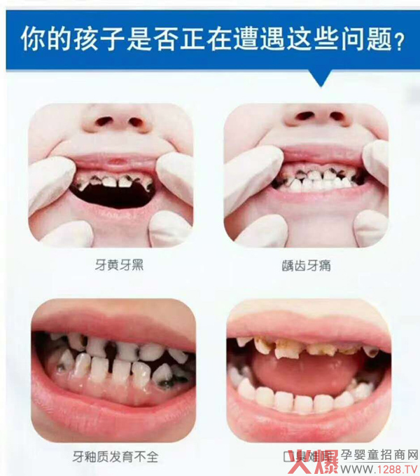 贝诺贝美口腔抑菌喷剂1.jpg