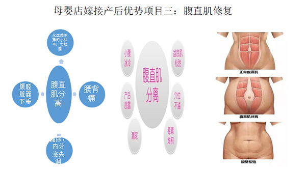 少林永化堂产后项目-腹直肌修复.jpg