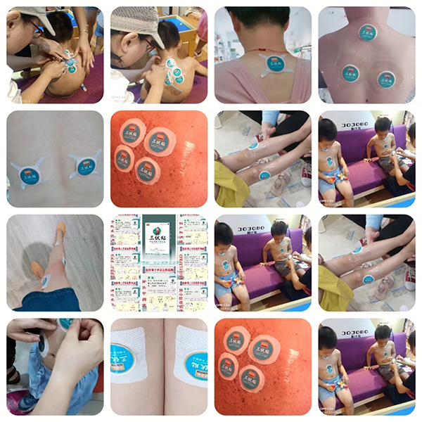 宝童健三伏贴产品展示.jpg